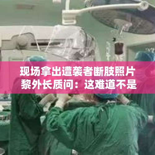 现场拿出遭袭者断肢照片 黎外长质问：这难道不是恐怖主义？