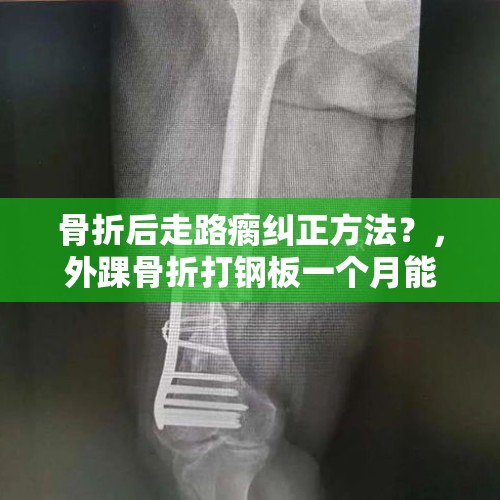 骨折后走路瘸纠正方法？，外踝骨折打钢板一个月能吃冰糕吗？