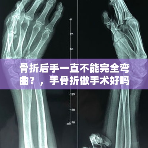 以军对黎巴嫩首都贝鲁特南郊发动空袭 - 今日头条