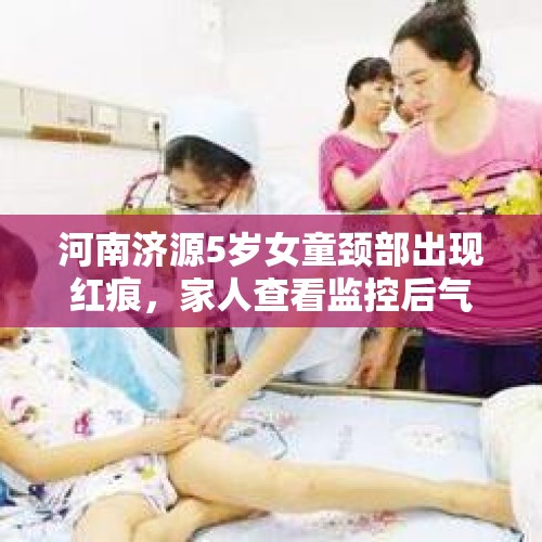 河南济源5岁女童颈部出现红痕，家人查看监控后气炸：幼儿园老师掐着脖子将她提起来 - 今日头条