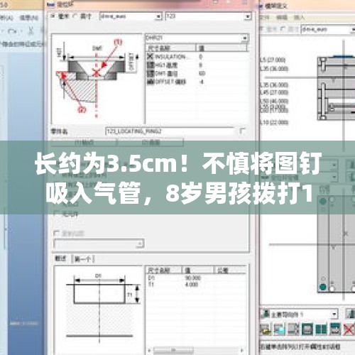 长约为3.5cm！不慎将图钉吸入气管，8岁男孩拨打120求救 - 今日头条