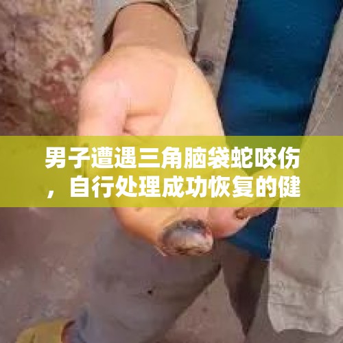 男子遭遇三角脑袋蛇咬伤，自行处理成功恢复的健康经历