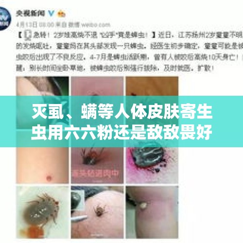 灭虱、螨等人体皮肤寄生虫用六六粉还是敌敌畏好在线等回答？，大妈学短视频用敌敌畏洗头，网红该对此负责吗？