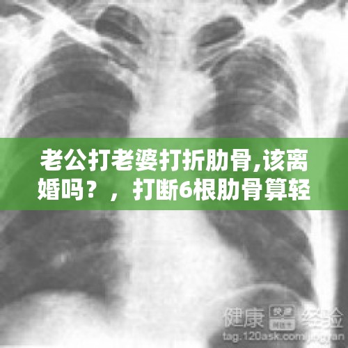 老公打老婆打折肋骨,该离婚吗？，打断6根肋骨算轻微伤么? 轻微伤如何量刑？需要坐牢么？