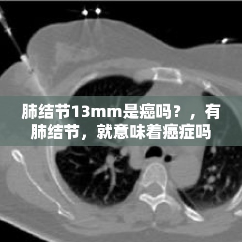 肺结节13mm是癌吗？，有肺结节，就意味着癌症吗？