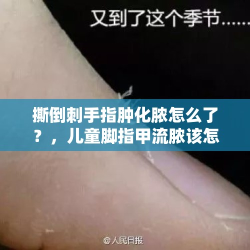 撕倒刺手指肿化脓怎么了？，儿童脚指甲流脓该怎么办？