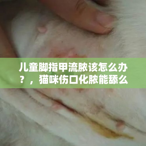 儿童脚指甲流脓该怎么办？，猫咪伤口化脓能舔么，猫咪伤口化脓，怎么办？